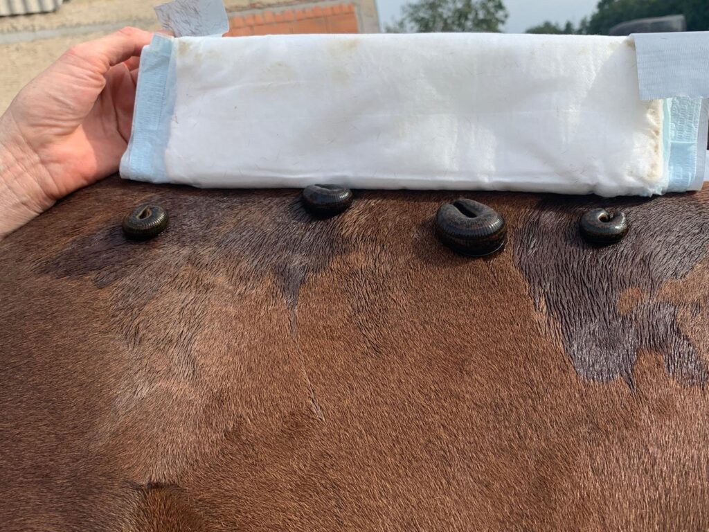 blutegeltherapie